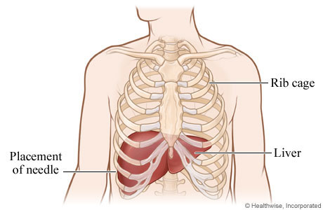 liver in ribcage